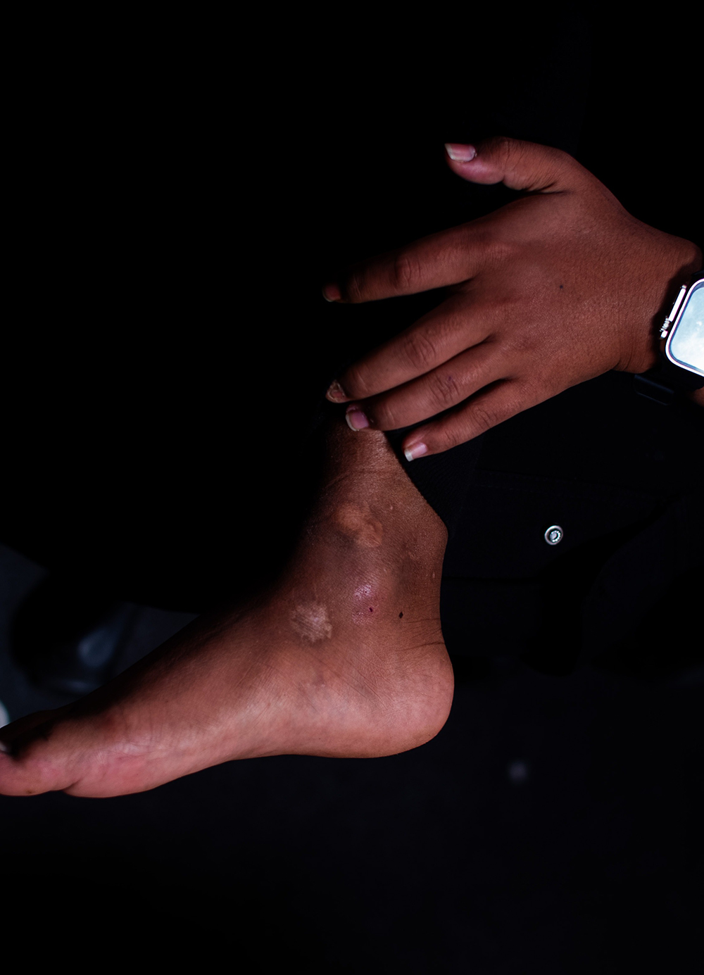 khat in foot.jpg
